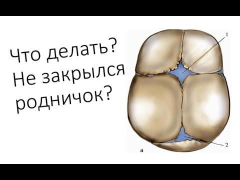 Видео: Что делать если у собаки не закрылся родничок?