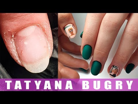 Видео: Оторванные Заусенцы/ Ногти Растущие ВВЕРХ/ Укрепление АкриГелем/ Татьяна Бугрий