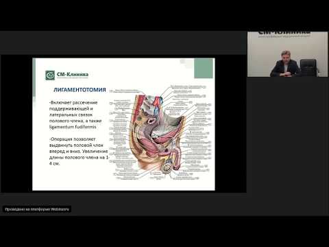 Видео: Запись вебинара «Эстетика в хирургии мужских половых органов» - Данилов А.О (11.07.2018)