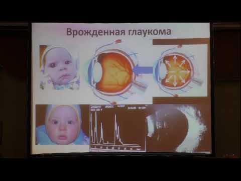 Видео: Ультразвуковые методы диагностики в детской офтальмологии