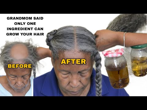 Видео: 😱ВЗОРВАЛ ИНТЕРНЕТ ЗА 3 ДНЯ! Я попробовал! Мои волосы отросли за 4 недели! Теперь они гуще.