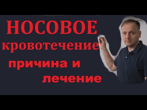 Видео: Носовое кровотечение | причина и лечение