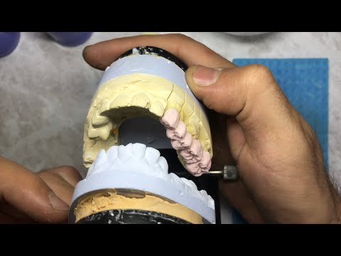 Видео: atamnatexnik зубной техник( часть-2 )
