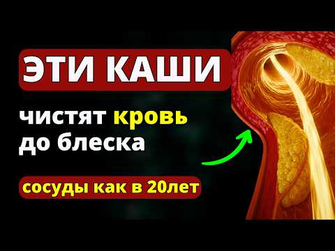 Видео: СЕРДЦЕ Будет Работать КАК ЧАСЫ! ЕШЬТЕ ЭТ КАШИ! Рецепты ТЕРАПЕВТА БОТКИНА