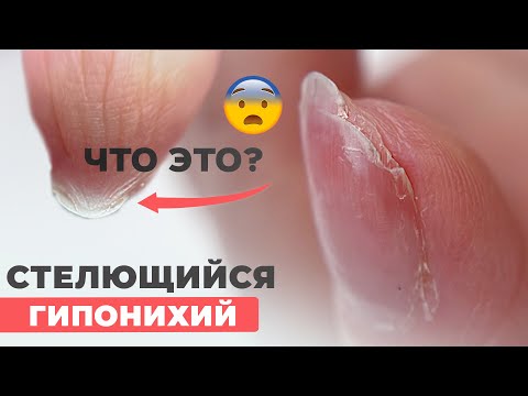 Видео: ГИПОНИХИЙ | Как сделать аппаратный маникюр и не поранить?