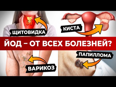 Видео: Что творит ЙОД? / Вот поэтому ЯПОНЦЫ не болеют и живут долго!