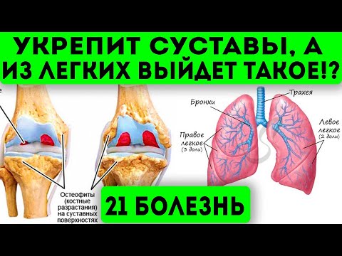 Видео: Этот народный настой из обычного розмарина лечит 21 болезнь! Суставы, легкие, грибок, омоложение и..
