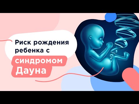 Видео: Синдром Дауна: диагностика во время беременности, причины возникновения, симптомы