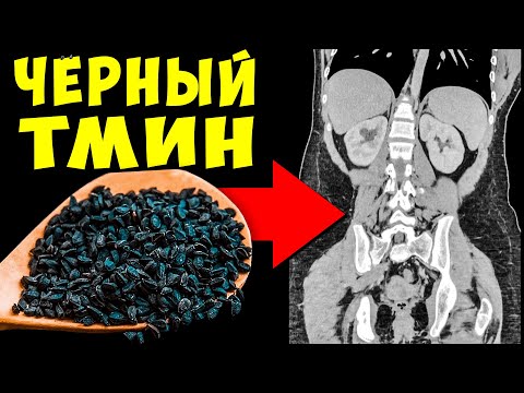 Видео: Вот что Творит обычный Чёрный Тмин, если Есть его Каждый день
