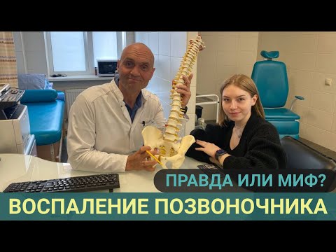 Видео: ВОСПАЛЕНИЕ ПОЗВОНОЧНИКА: ПРАВДА ИЛИ МИФ?