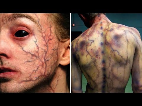 Видео: 7 Людей, Которые Получили Суперспособности в Результате Несчастного Случая