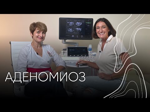 Видео: Аденомиоз | Людмила Шупенюк и Волык Нелла