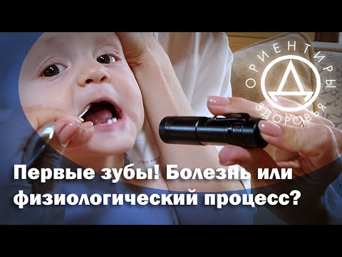 Видео: Первые зубы! Болезнь или физиологический процесс?