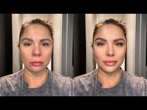 Видео: ПОДТЯНУТЬ ЛИЦО ЗА 10 МИНУТ | Легкий массаж лица в домашних условиях #фейсфитнес #массажлица