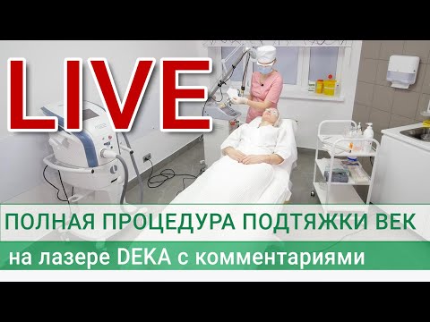 Видео: Полная процедура подтяжки век на лазере DEKA с комментариями. Блефаропластика