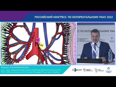 Видео: ЧТО ЖДАТЬ ОТ D3 ЛИМФОДИССЕКЦИИ ПРИ КОЛОРЕКТАЛЬНОМ РАКЕ?