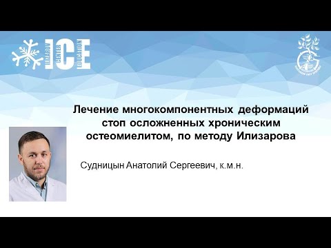 Видео: Лечение многокомпонентных деформаций стоп осложненных хроническим остеомиелитом, по методу Илизарова