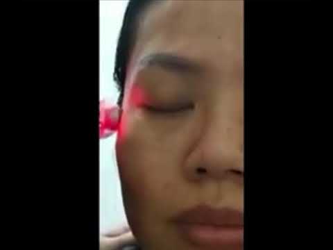 Видео: Косметический Ионный массажёр FOHOW