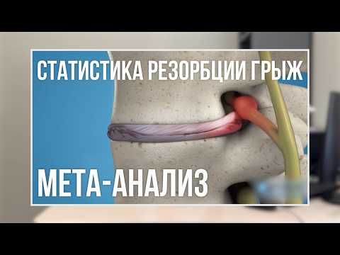 Видео: Как часто рассасываются грыжи межпозвонковых дисков и от чего это зависит? Научный обзор