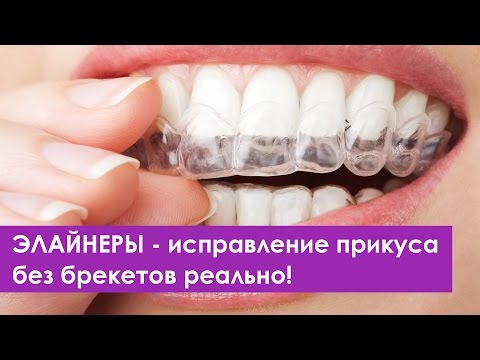 Видео: День отрытых дверей и интервью с основателем компании Star Smile