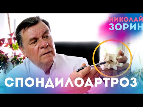 Видео: Спондилоартроз. Ответы на вопросы зрителей
