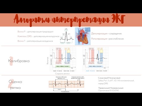 Видео: Научись читать ЭКГ за 14 минут!!! Простой алгоритм интерпретации ЭКГ