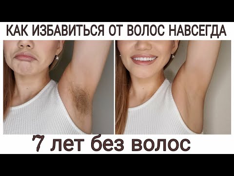 Видео: Как я избавилась от нежелательных волос навсегда.Плюсы и Минусы. Лазерная эпиляция или Фотоэпиляция?