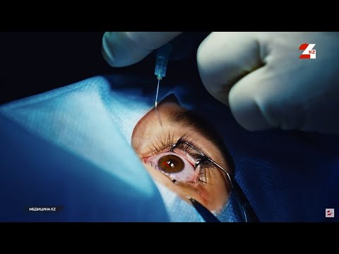 Видео: Лазерная коррекция зрения: можно ли довериться? Как выбрать безопасный метод? | Медицина KZ