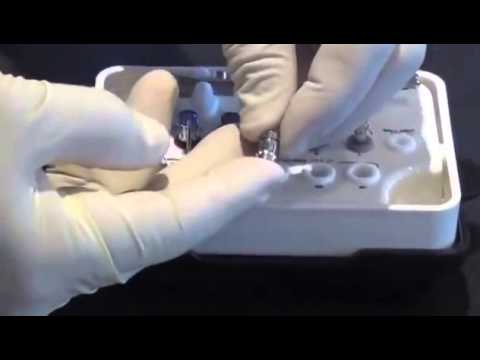 Видео: Обзор набора для протезирования AnyRidge