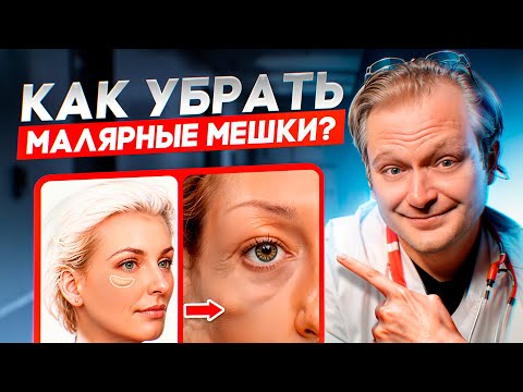 Видео: Как убрать малярные мешки? Самый действенный способ