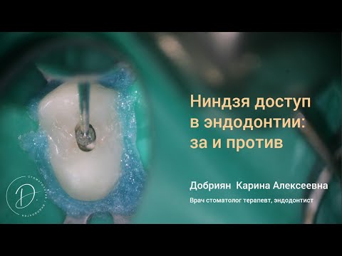 Видео: Вебинар «НИНДЗЯ ДОСТУП В ЭНДОДОНТИИ: ЗА И ПРОТИВ»