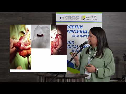 Видео: 49. Законите на привличането – магнитите и децата, You Loves Of Attraction – Magnets Ant Children