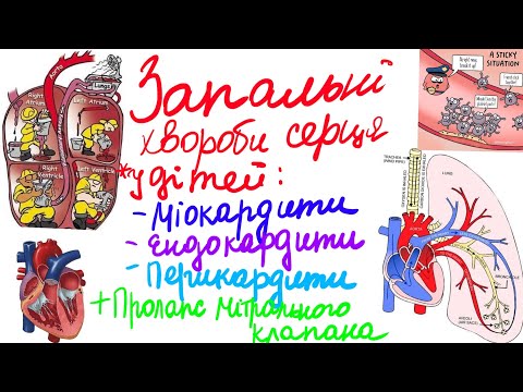 Видео: Запальні і незапальні хвороби серця. Частина 1: запальні хвороби серця: міо-, ендо-, епікардит + ПМК