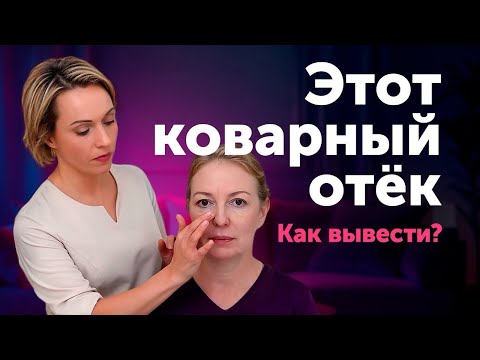 Видео: Почему ЭТОТ ОТЁК НЕ УХОДИТ? Разбор реального случая