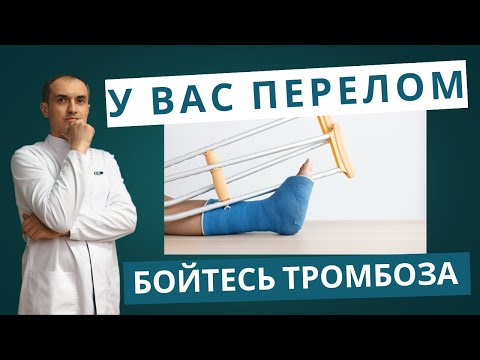 Видео: Не повторяйте ошибки пациента с переломом ноги! Флеболог Москва.