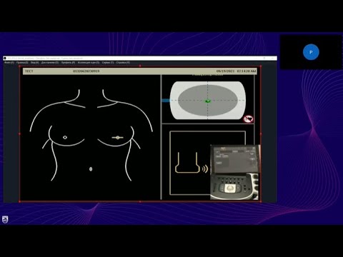 Видео: Инструмент для исследования молочной железы Philips AI Breast
