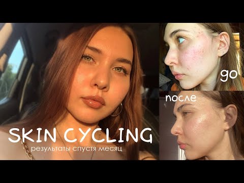 Видео: SKIN CYCLING | РЕЗУЛЬТАТЫ за МЕСЯЦ | КРУГОВОЙ УХОД