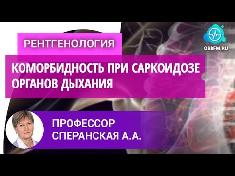 Видео: Профессор Сперанская А.А.: Лучевая диагностика коморбидной патологии при саркоидозе органов дыхания