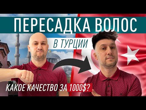 Видео: Пересадка волос в Турции. Основные вопросы. Цена - 1000 USD?