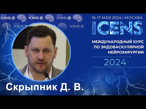 Видео: Скрыпник Д. В., «Эндоваскулярное лечение ишемического инсульта в 2024 году в Москве. Что нового?».