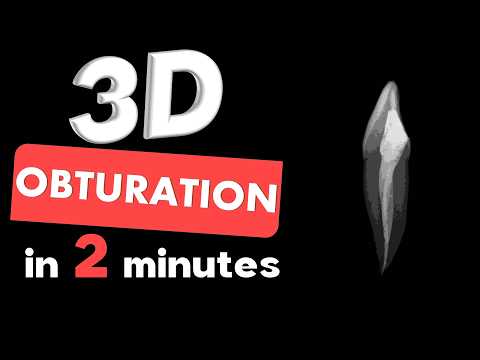 Видео: 3D ОБТУРАЦИЯ | Обтурация гуттафлоу