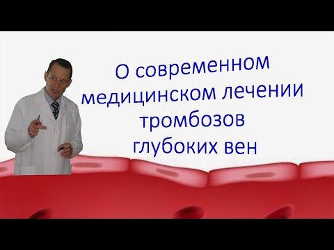 Видео: Тромбоз глубоких вен, как современная медицина лечит. Беседа для ВСЕХ.