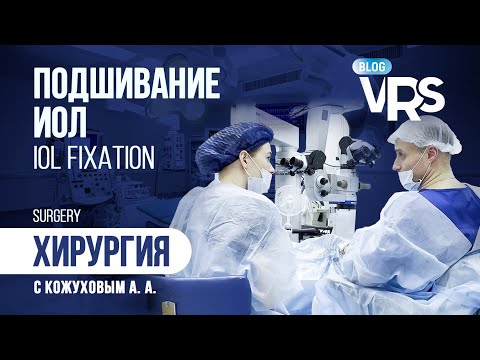 Видео: Подшивание ИОЛ. Хирургия с Кожуховым А. А. | IOL fixation.