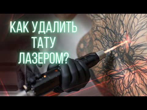 Видео: Как удалить тату лазером? Баски о тату