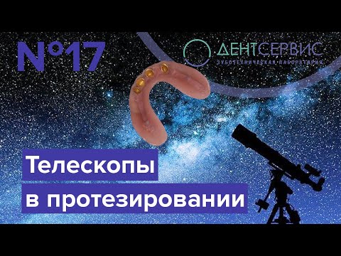 Видео: Что такое телескопические коронки?