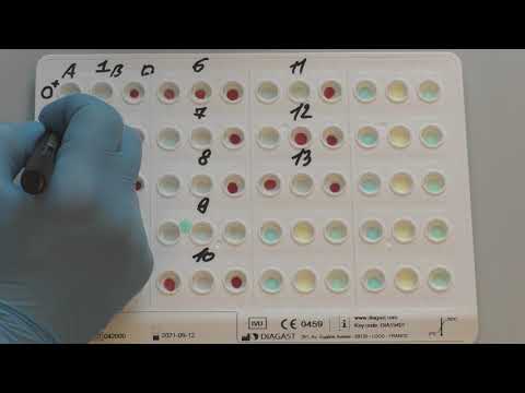 Видео: Определение группы крови на планшете ABD PAD.