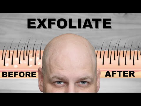 Видео: ВАМ НУЖНО ОТШЕЛУШИВАТЬ лысую голову, и вот почему