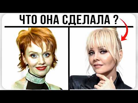 Видео: Почему Валерия выглядит на 25, а ей 57? Пластический хирург в Шоке...