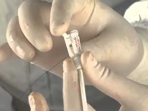 Видео: Наружная холангиостомия.Лекция.д.м.н.проф.Кулезнева Ю.В., д.м.н.проф.Израилов Р.Е.