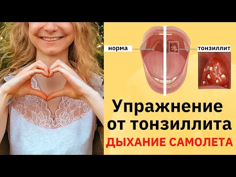 Видео: Пробки вылетают! Упражнение от хронического тонзиллита Дыхание самолета